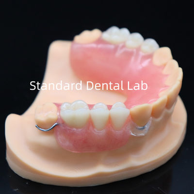 comprare Protesi parziale acrilica ad alta estetica con chiusura trasparente e denti acrilici China Dental Lab fabbricazione online