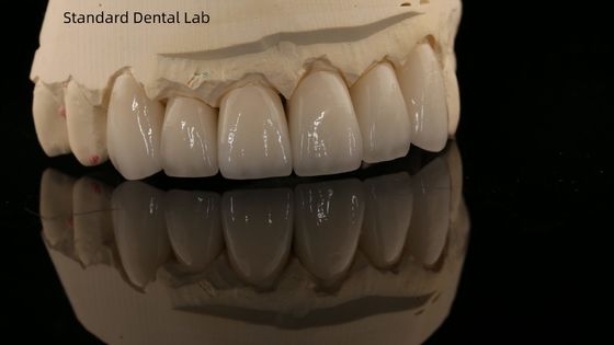 comprare Corona di zirconia a contorno completo e ponte dentale naturale di alta estetica Garanzia di 5 anni fabbricazione online