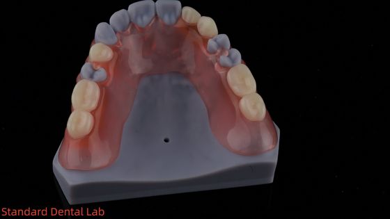 comprare Modello di stampa 3D Alta estetica dentale TCS Valplast Flessibili protesi parziali Laboratorio dentale fabbricazione online