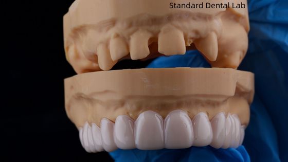 comprare Dental Snap On Smile Standard Dental Lab Apparecchio dentale rimovibile fabbricazione online