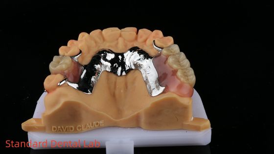 comprare CorCr Metallo Parziale Dentiera Alta luce Berillio Libero Ivoclar Scheftner Confortevole Metallo Framewrok fabbricazione online