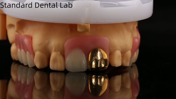 comprare Protesi dentali acriliche complete con denti d'oro giallo/Dental Temporary Acrylic Denture Ivoclar Professional FDA Approved fabbricazione online