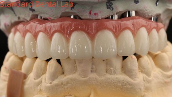 comprare Porcellana All On Four Ponte di zirconia Alta estetica Ponte di impianti dentali fabbricazione online