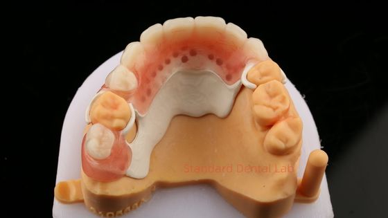 comprare Peek Partial Frame Design ISO CE And FDA Dental Lab Acrilico Parziale Denture Framework fabbricazione online