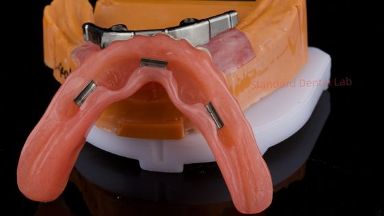 comprare Ivoclar Digital Dental Implant Bar Denture con Appendici Denture Full Acrylic Denture Denture Titanium Implant Supported fabbricazione online