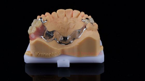 comprare Denti parziali in cobalto cromo Ivoclar Scheftner Confortevole telaio in metallo consegnato in soli 3 giorni fabbricazione online