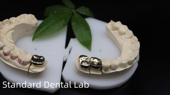 comprare Professionale ISO e FDA approvato Corona d'oro giallo per laboratorio dentale Spedizione UPS o Fedex Tempo di produzione 2 giorni fabbricazione online