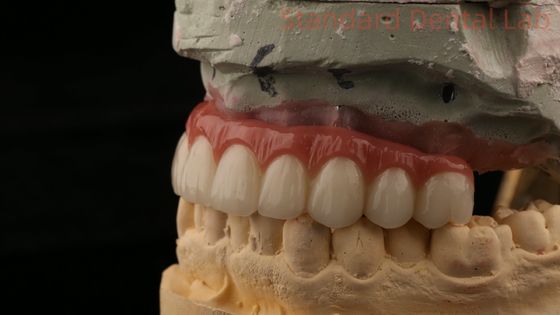 comprare Ibrido di titanio a vite corona dell'impianto dentale tutto su 4 Impianto dentale zirconia ponte fabbricazione online