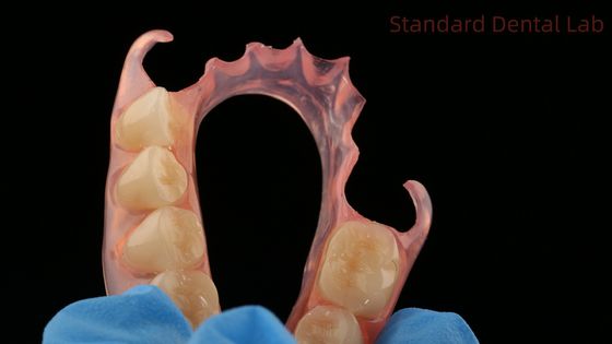 comprare Dental TCS Valplast Flessibile Parziale Protesi Dental Laboratorio 3D Modello di stampa Alta estetica fabbricazione online
