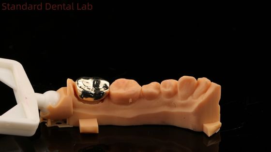 comprare Professionale di denti con corona d'oro giallo, riconosciuto ISO e FDA. fabbricazione online