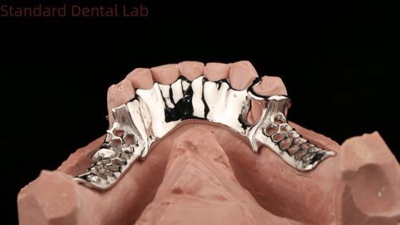 comprare Cornice in metallo fuso in cobalto cromo protesi parziali con grembiule inferiore Design SDL Dental Lab fabbricazione online