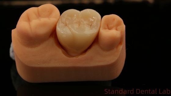 comprare Fresatura e centrificazione di corona di zirconia, laboratorio dentale cinese consegna rapida fabbricazione online