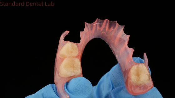comprare Modello di stampa 3D dentale TCS Valplast Flessibile Partial Dentures Prodotto di laboratorio dentale rosa / scuro fabbricazione online