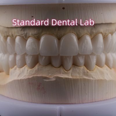 Laboratorio dentale Corone di porcellana in zirconia a arco pieno PFZ Corona ISO FDA CE