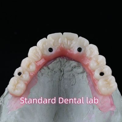 Porcellana Zirconia Dental Implant Bridge Professionale Alta Estetica Con Gomma Rosa