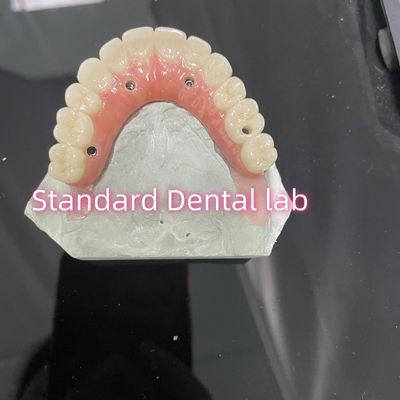 All On Four Six Ivoclar Zirconia Implant Bridge Bar di Titanio Con Porcellana Rosa Gomma