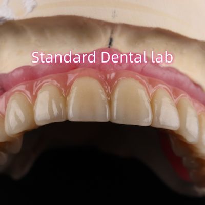 Cimento veloce e risparmio di tempo Impianto prodotti dentali Circonia corone ponte