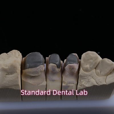 Metallo Cast Post Core Crown Cocr Accurate Retentive Full Zirconia Bruxier