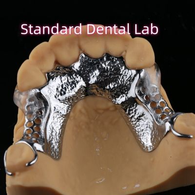Stampa laser Protesi parziale in cobalto cromo con chiusure trasparenti