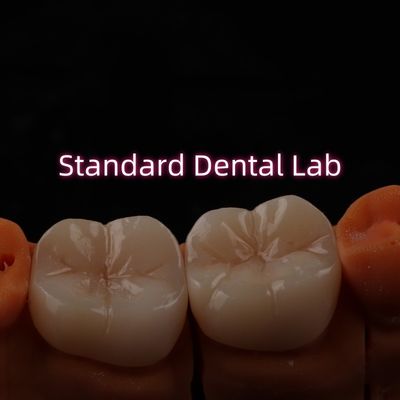 Full Contour Bruxier Monolitico Zirconia Crown Bridge Dental Lab