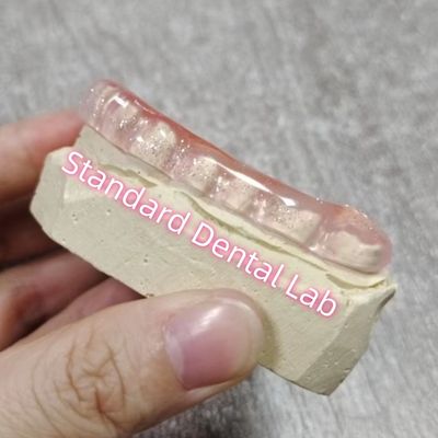Bruxismo dentale oclusiale spina di guardia notturna laboratorio dentale standard