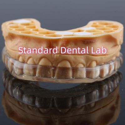 Protezione dentale professionale personalizzata contro il russare Protezione orale notturna aggiornata per la strofinatura dei denti
