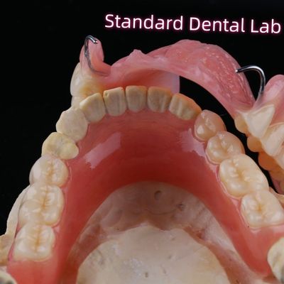 Restituzioni dentali rimovibili denti parziali acrilici con chiusure di filo