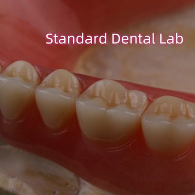SDL Protesi parziale acrilica termicurata Ivoclar Denti Laboratorio dentale Alta precisione