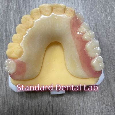 OEM ombra di denti in fuso rimovibile protesi parziali in acrilico con cerniere