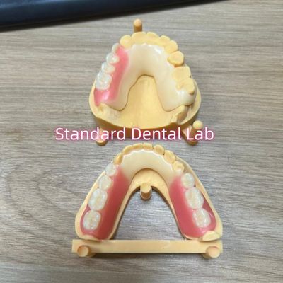 Sfumature estetiche dei denti Quadro acetale Colorazioni dei denti