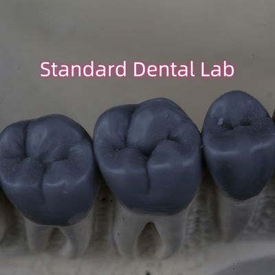 Professionale Digital Dental Lab Wax Up 3shape approvato dalla FDA
