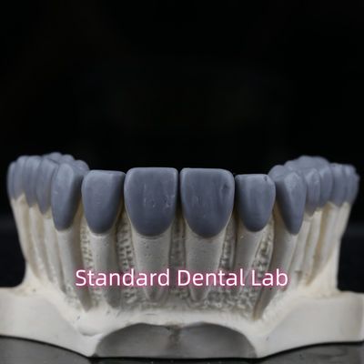Dental Crown Wax Up Estetica elevata