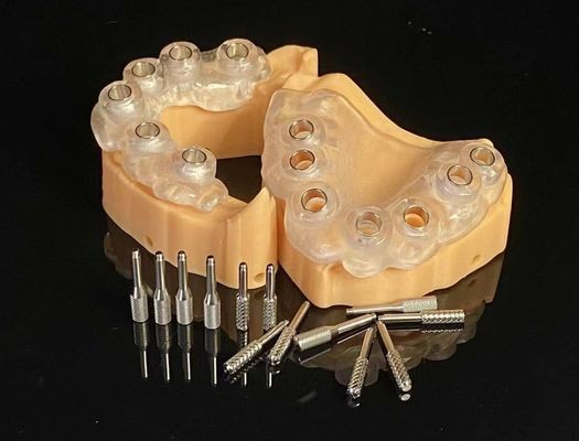 Guida chirurgica 3D per l'impianto dentale