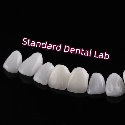 Resistenza all'abrasione Emax Zirconia Finiture laminate Traslucidità incisiva