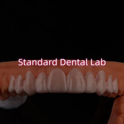 Fenerie per il sorriso per denti scoloriti / spazi