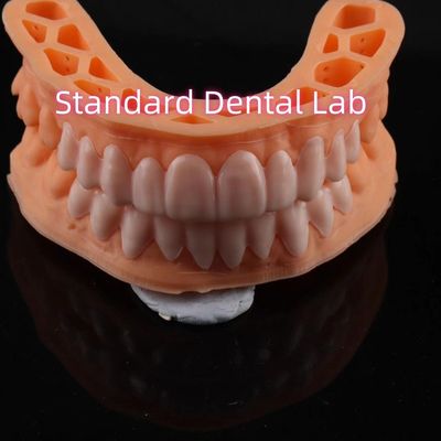OEM ODM Pop On Veneers Veneers personalizzati Snap On Smile