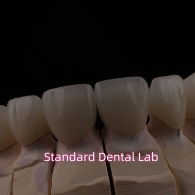 Ponte di zirconia in ceramica a strati dentali PFZ con incisivo traslucido