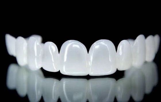 Disegni dentali rimovibili con rivestimento di finestre Bianco di neve