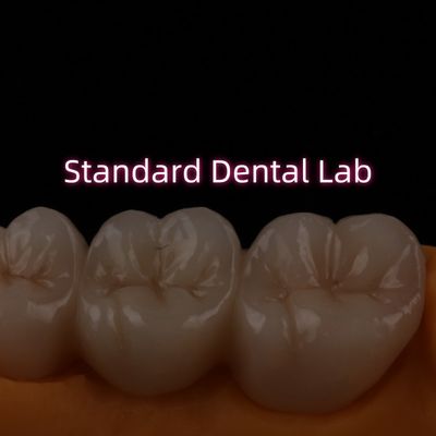 Alto trasparente PFZ stratificato zirconia ponte porcellana ceramica posteriore