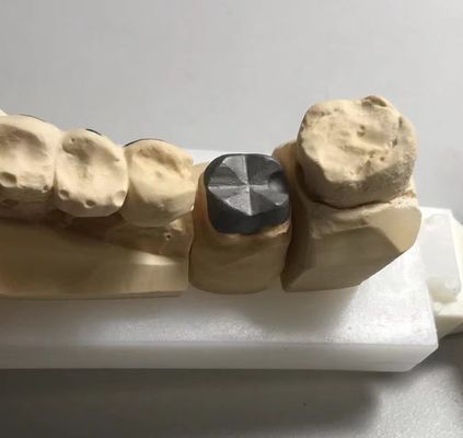 ISO FDA CE Dental Metal Post And Core Crown PFM Buona vestibilità