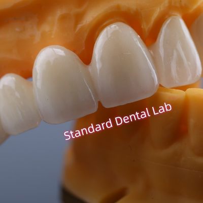 CAD CAM Mill Zirconia Crown Bridge Altamente biocompatibile