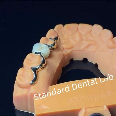 Dental Teeth PFM Maryland Bridge Alta estetica Certificato FDA