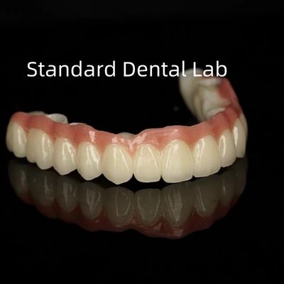 Estetica Porcellana monolitica Corona di zirconia Traslucidità a arco pieno