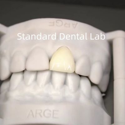 Corone di laboratorio dentale digitale CAD CAM Corone di zirconia a strati traslucida