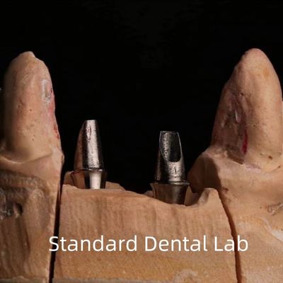 Dental Porcellana Zirconia Impianto Corona Professionale Alta Estetica