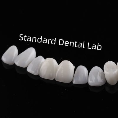 Denti di elevata estetica Emax finiture laminate Traslucidità incisiva