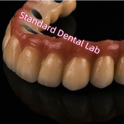 Cobalto cromo Ivoclar laser sinterizzato PFM corona di metallo porcellanato ponte A1 A2 A3