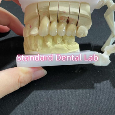 Fuso PFM Non Precious CoCr Metal Porcellana Bridge Dental CCM