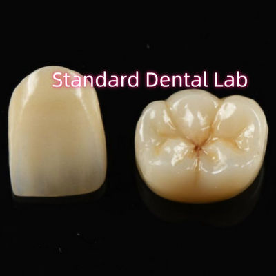 Materiale biocompatibile Circonia estetica corona di zirconia denti ponte