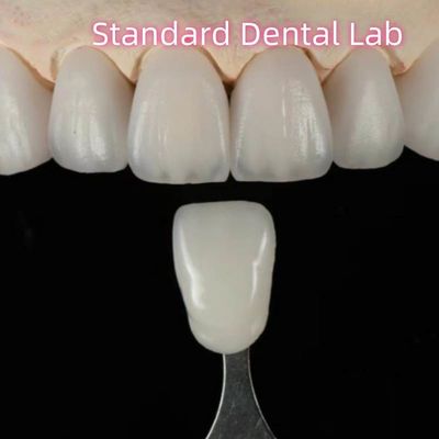 Ponte dentale di zirconia di alta estetica naturale su misura